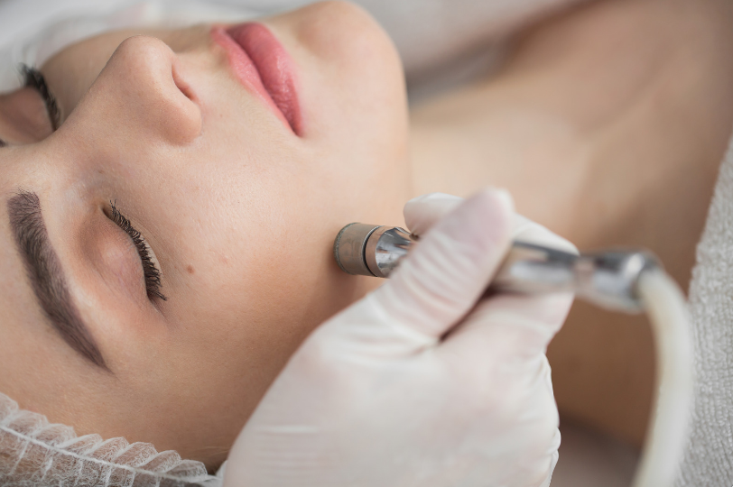 microdermabrasion